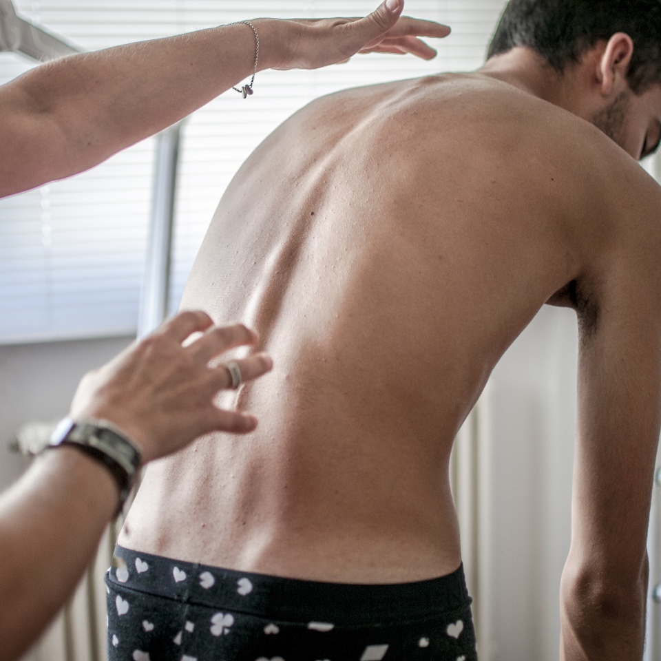 doctor performs a medical examination on a patient diagnosed with scoliosis